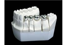 Addytywne wytwarzanie pomaga dentystom